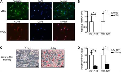 miRNA Expression Profiling Uncovers a Role of miR-139-5p in Regulating the Calcification of Human Aortic Valve Interstitial Cells